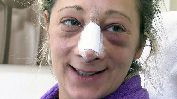 "Extrem schön" - So haben sich Karin und Alessandra verwandelt