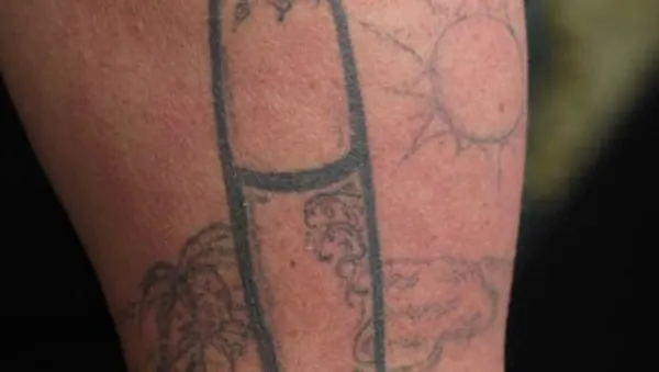 TLC - Tattoo Desaster - Bild 1