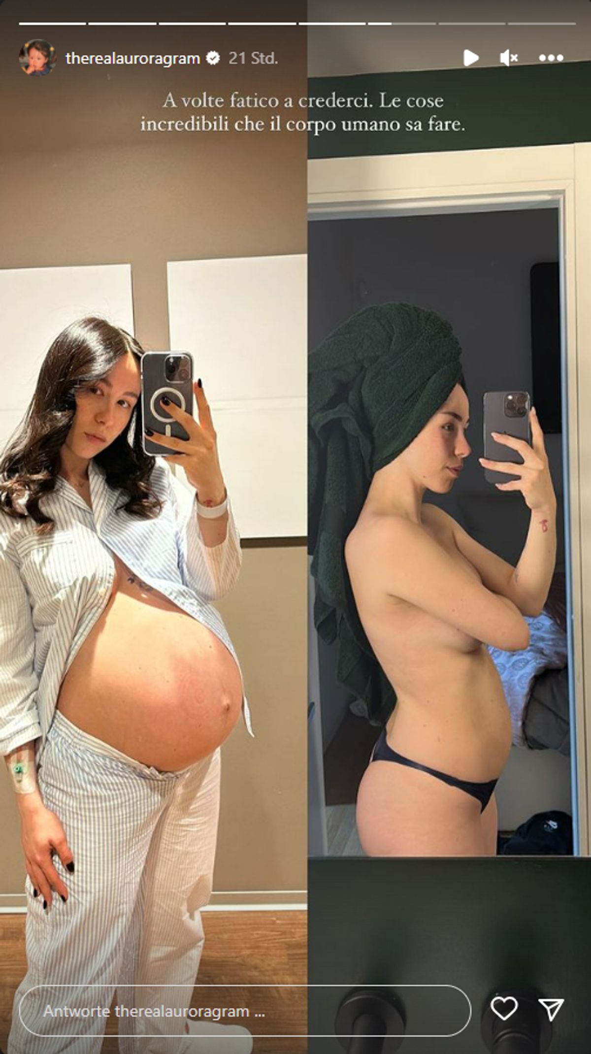 Aurora Ramazzotti - After-Baby-Body