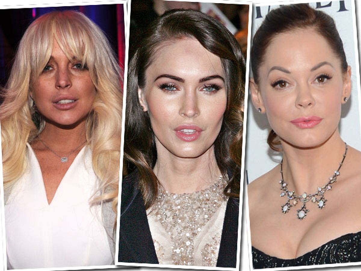 Die Beauty-Sünden der Stars: Diese Promis bereuen ihre Schönheits-OPs - Bild 1