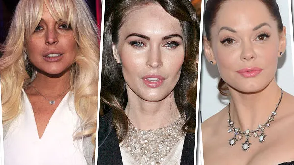 Die Beauty-Sünden der Stars: Diese Promis bereuen ihre Schönheits-OPs - Bild 1