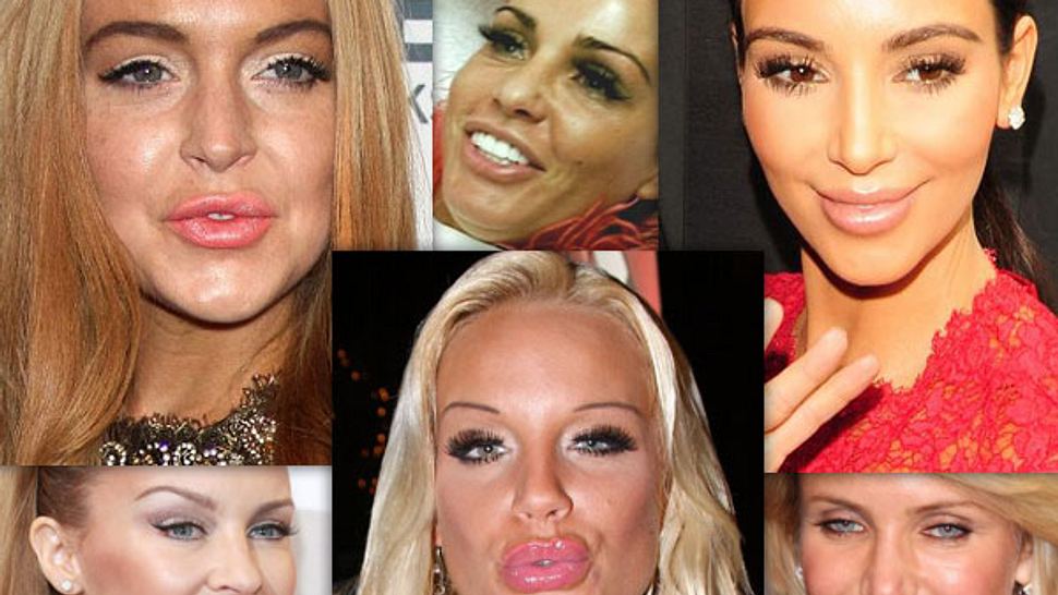 Botox, Lippen aufspritzen & Co.: Hollywood zeigt sein Gesicht - Bild 1 - Foto: WENN