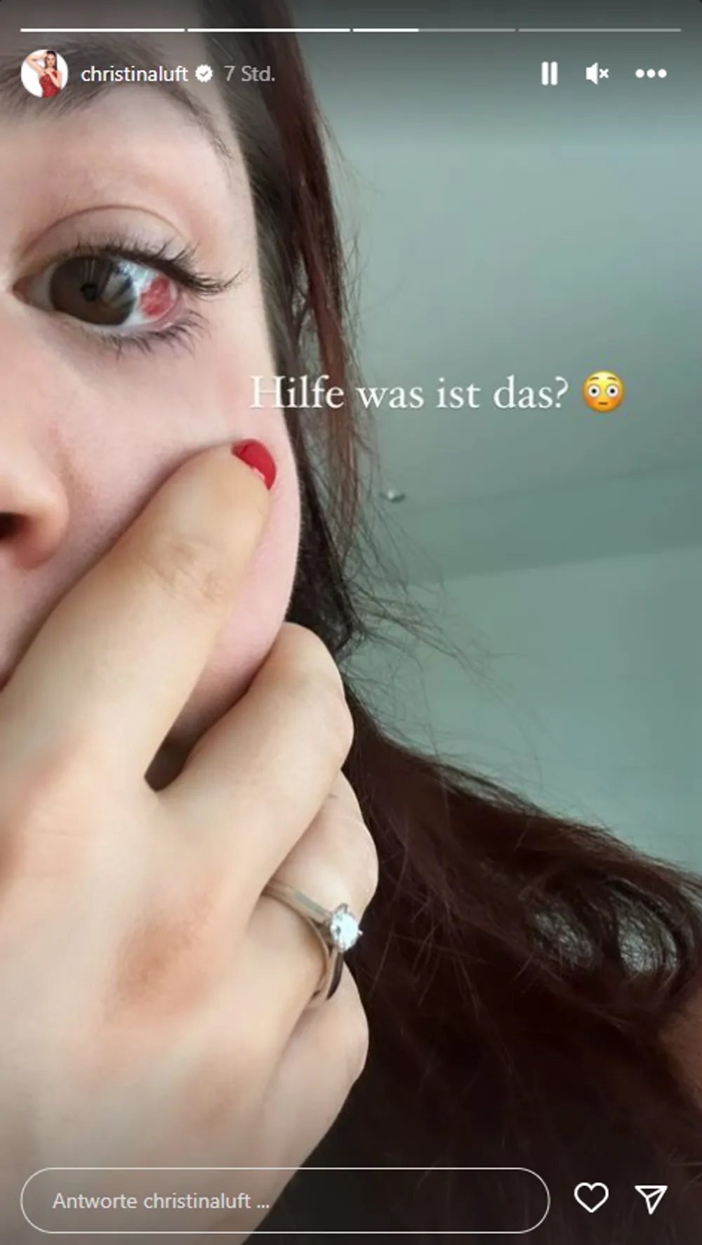Christina Luft - roter Fleck im Auge Christina Luft - roter Fleck im Auge