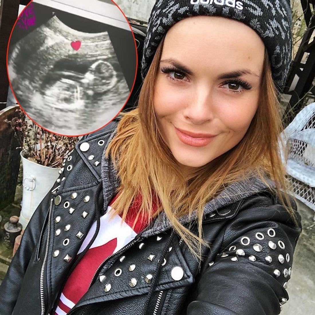 Schwangere Denise Temlitz: Süße Ultraschall-Bilder von ihrem Baby