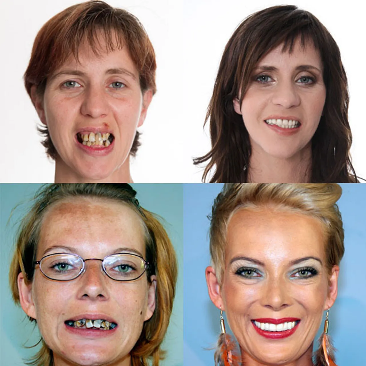 "Extrem schön": Die Highlights der vergangenen Staffeln Extrem schön: Die Highlights der vergangenen Staffeln - Foto: RTL II