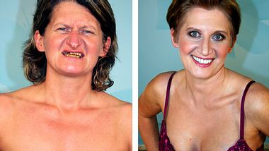 Extrem schön!Ein extremer Unterschied: Natalia vor und nach unzähligen Behandlungen. - Foto: © RTL II