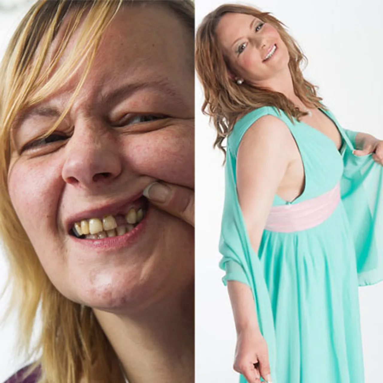 Beate: Vorher und nachher Beate: Vorher und nachher - Foto: RTL II