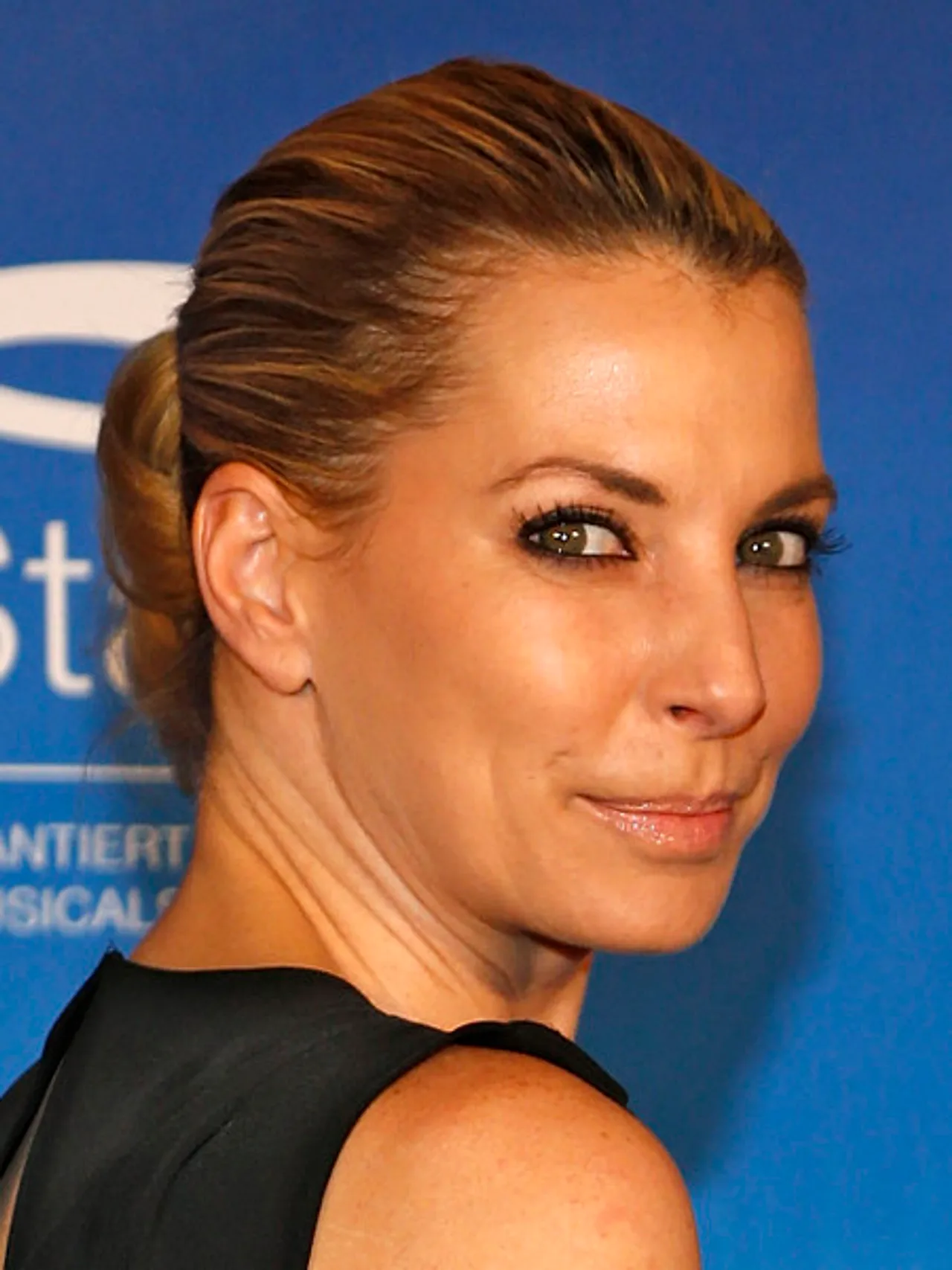 Giulia Siegel leidet unter Nesselsucht Giulia Siegel leidet unter Nesselsucht - Foto: Getty Images