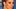 Giulia Siegel leidet unter Nesselsucht - Foto: Getty Images