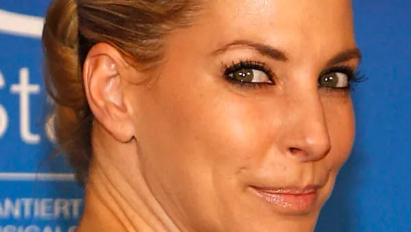 Giulia Siegel leidet unter Nesselsucht