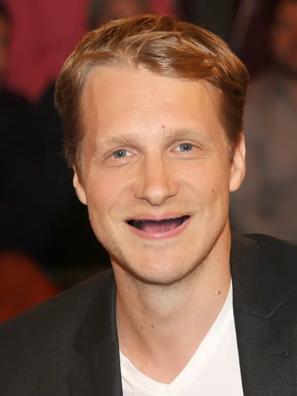 Deutsche Promis OHNE Zähne! - Bild 12