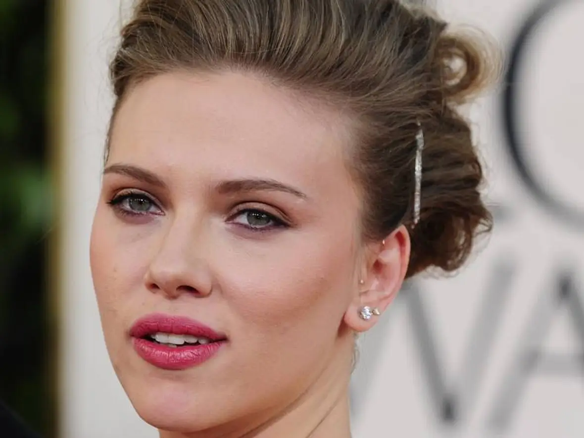 VIP-Hobby: Lippen aufspritzen! Star-Schnuten vom Schönheits-Doc - Bild 7