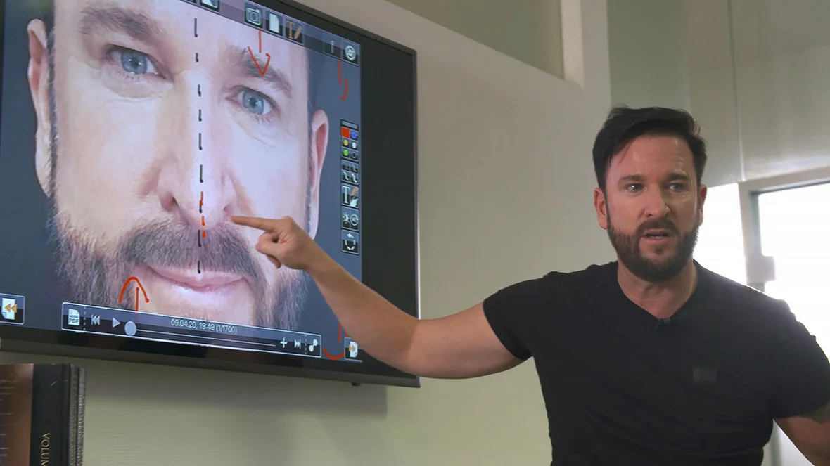 Michael Wendler wünscht sich eine neue Nase Michael Wendelr