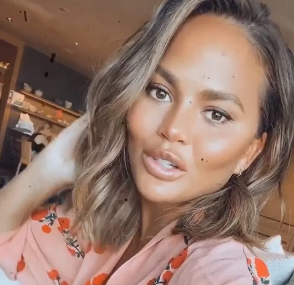 Chrissy Teigen Chrissy Teigen