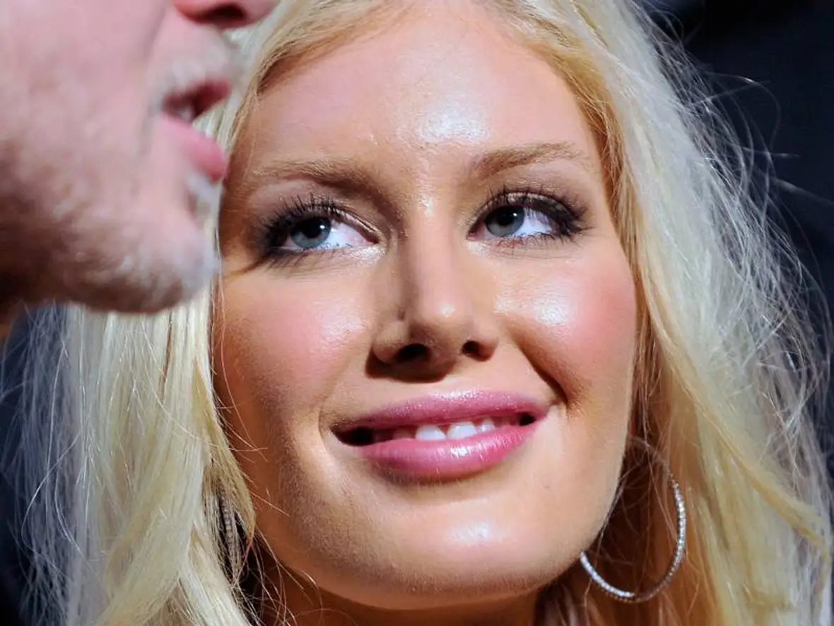 VIP-Hobby: Lippen aufspritzen! Star-Schnuten vom Schönheits-Doc - Bild 4