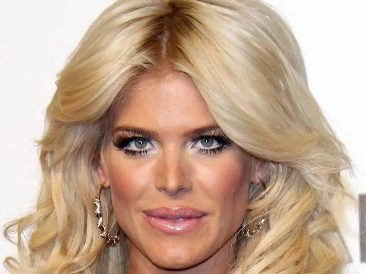 VIP-Hobby: Lippen aufspritzen! Star-Schnuten vom Schönheits-Doc - Bild 9
