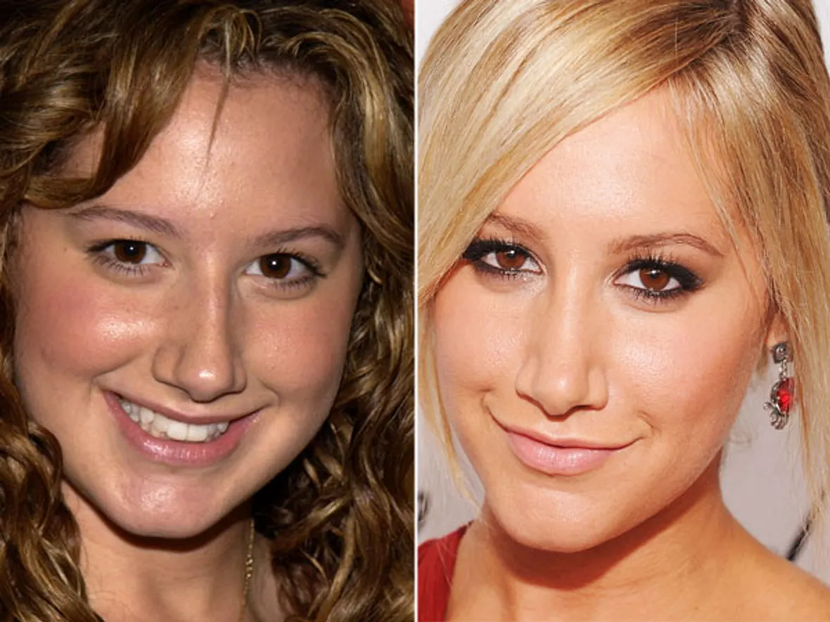 Ashley Tisdale Nasen-OP? Ja, bitte! Stars im Vorher-Nachher-Vergleich