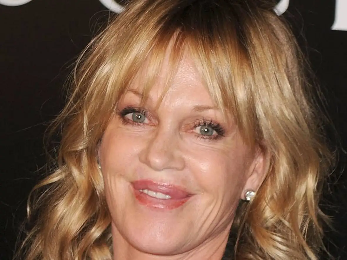 VIP-Hobby: Lippen aufspritzen! Star-Schnuten vom Schönheits-Doc - Bild 11