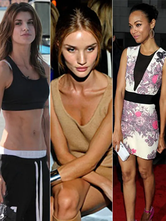 "Skinny Stars" - Promis im Magerwahn - Bild 1