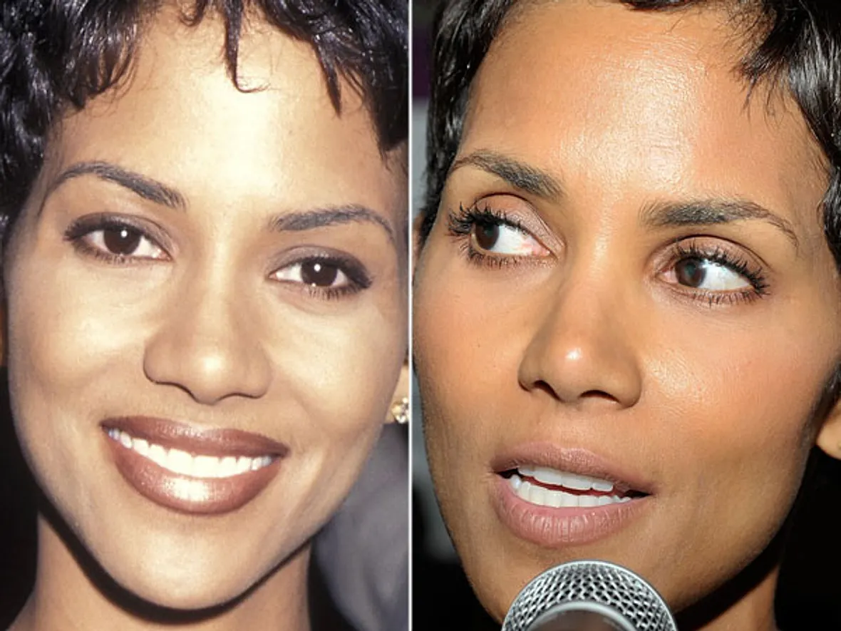Halle Berry Nasen-OP? Ja, bitte! Stars im Vorher-Nachher-Vergleich