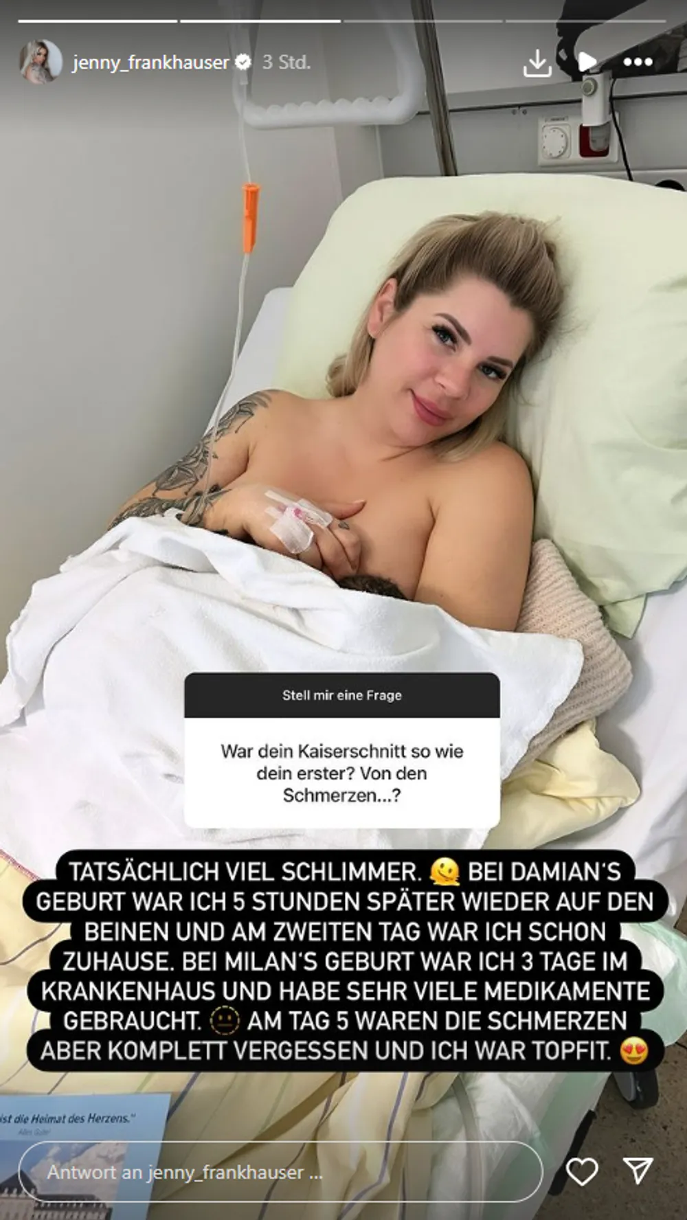 Jenny Frankhauser über Kaiserschnitt: Jenny Frankhauser über Kaiserschnitt:
