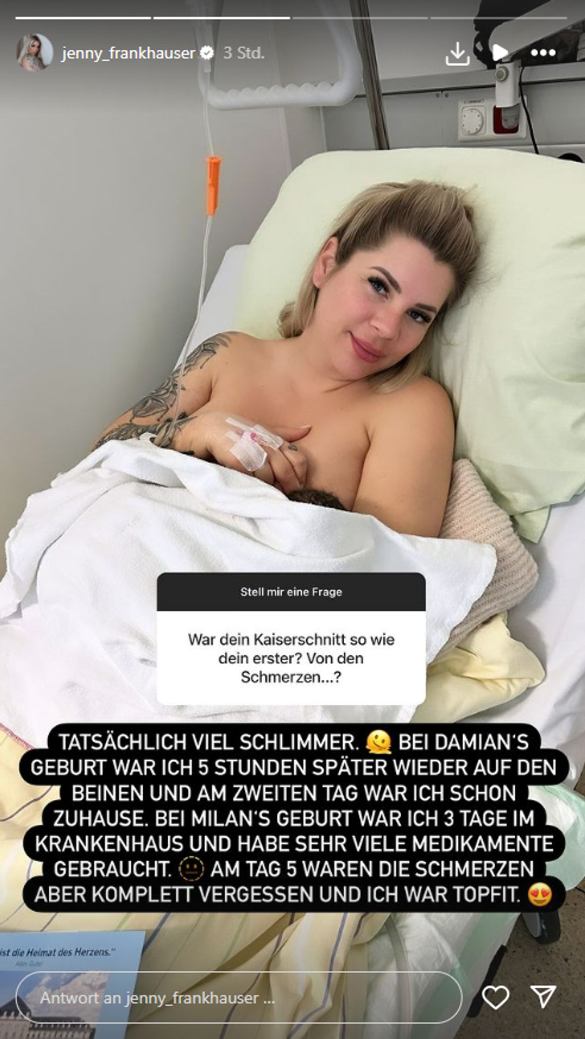 Jenny Frankhauser über Kaiserschnitt: