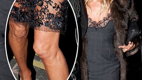 Kate Moss zeigt ihre faltigen Knie - Foto: GettyImages
