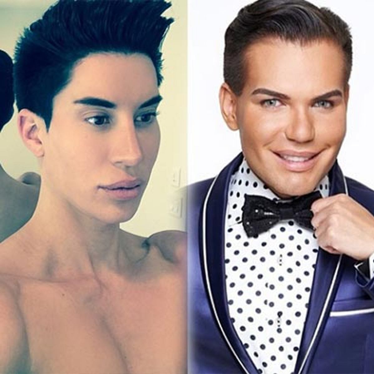 Justin Jedlica vs. Rodrigo Alves