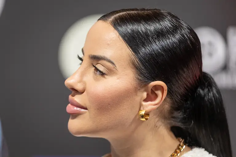 Leyla Lahouar hat sich kurz vor ihrer Hochzeit mit Mike Heiter die Lippen auflösen lassen. 