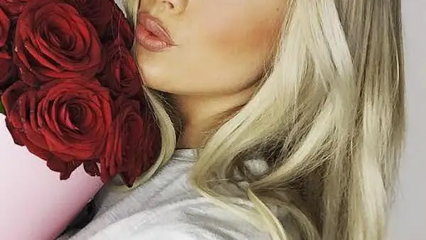 Lippen unterspritzt: Liz Kaeber gesteht Gang zum Beauty-Doc