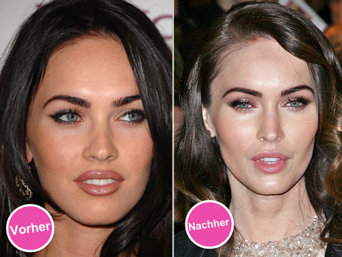 Die Beauty-Sünden der Stars: Diese Promis bereuen ihre Schönheits-OPs - Bild 7