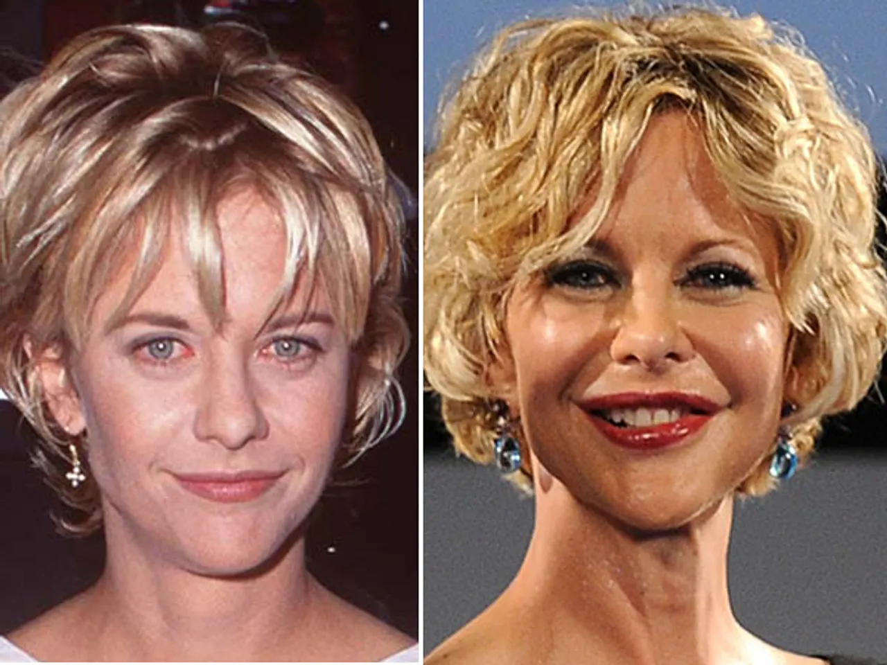 Dank Botox ist Meg Ryan kaum mehr zu erkennen Dank Botox ist Meg Ryan kaum mehr zu erkennen - Foto: Getty images