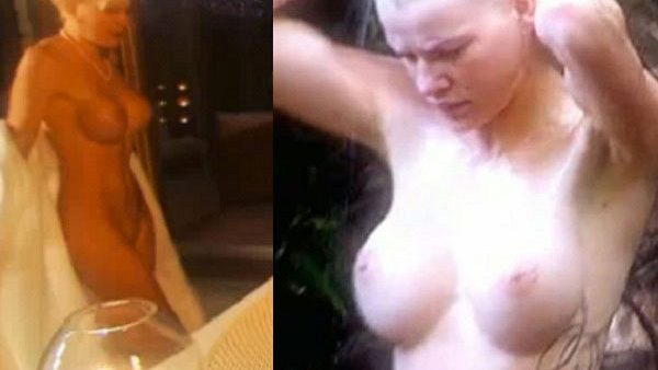 Melanies Brüste vorher und nachher - Foto: RTL