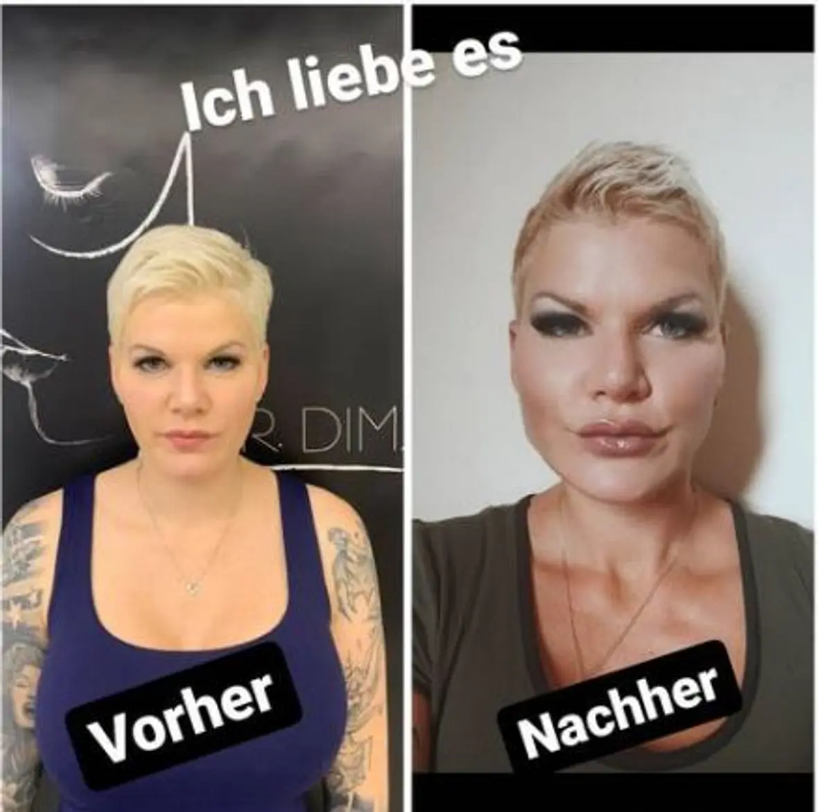 Melanie Müller Melanie Müller