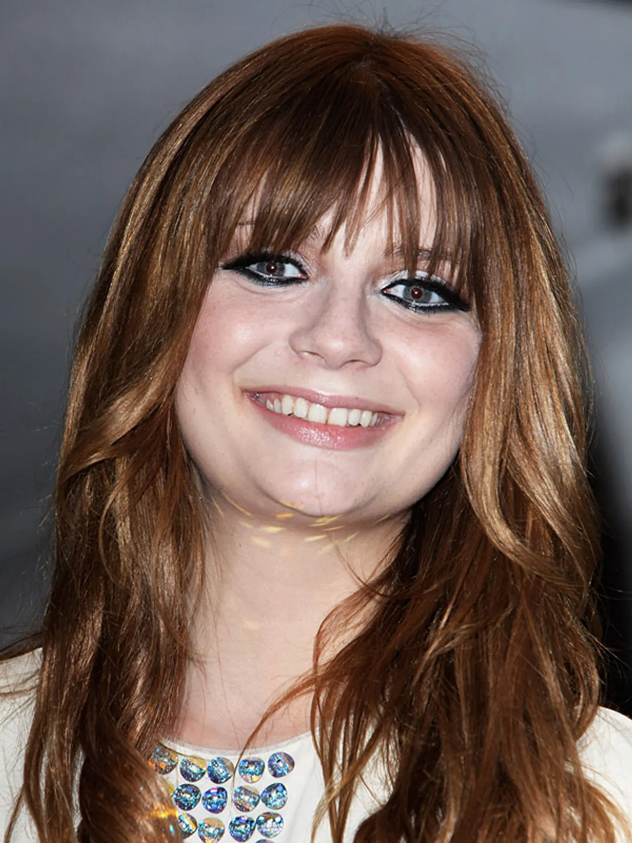 Seit kurzem ist das Gesicht von Mischa Barton unnatürlich aufgeschwemmt - aber woran liegt's? Seit kurzem ist das Gesicht von Mischa Barton unnatürlich aufgeschwemmt - aber woran liegts? - Foto: GettyImages