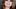 Seit kurzem ist das Gesicht von Mischa Barton unnatürlich aufgeschwemmt - aber woran liegts? - Foto: GettyImages