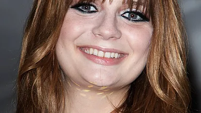 Seit kurzem ist das Gesicht von Mischa Barton unnatürlich aufgeschwemmt - aber woran liegt's?