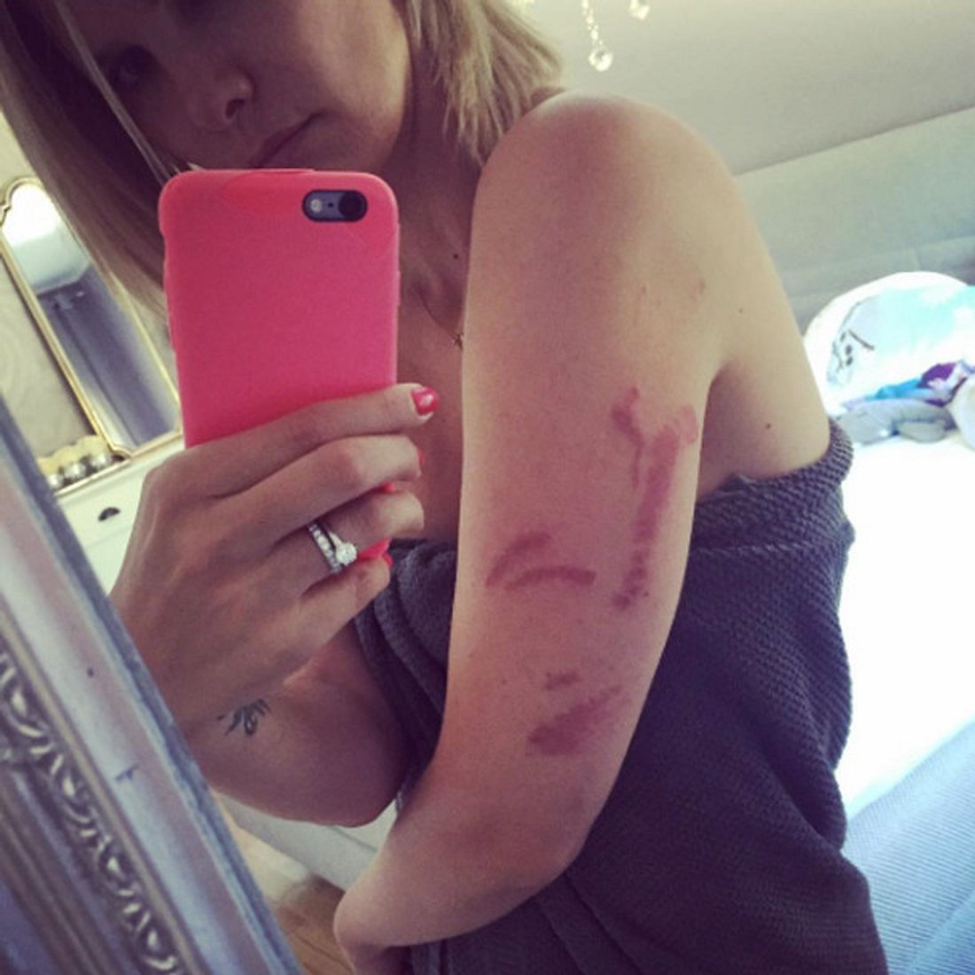 Monica Ivancan wurde von einer Feuerqualle attackiert