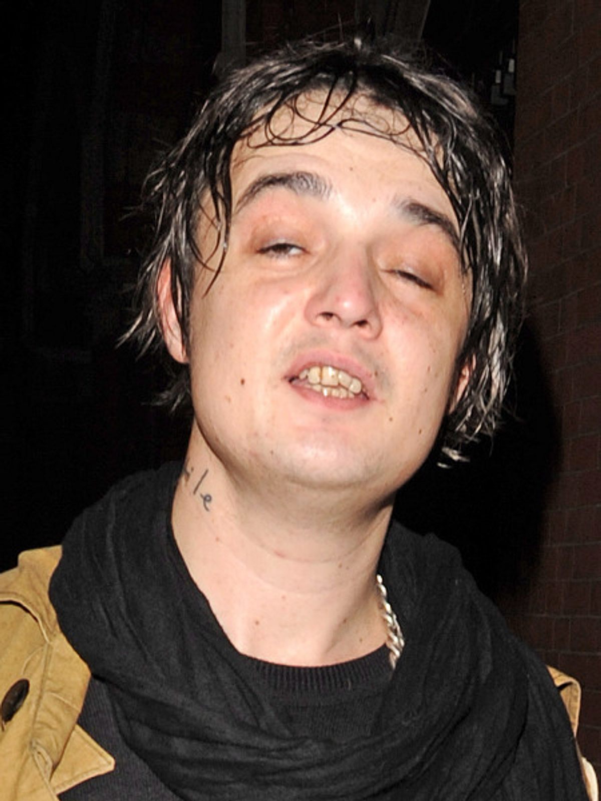 So schlecht soll es Pete Doherty nie mehr gehen.