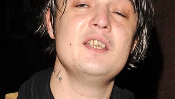 So schlecht soll es Pete Doherty nie mehr gehen.