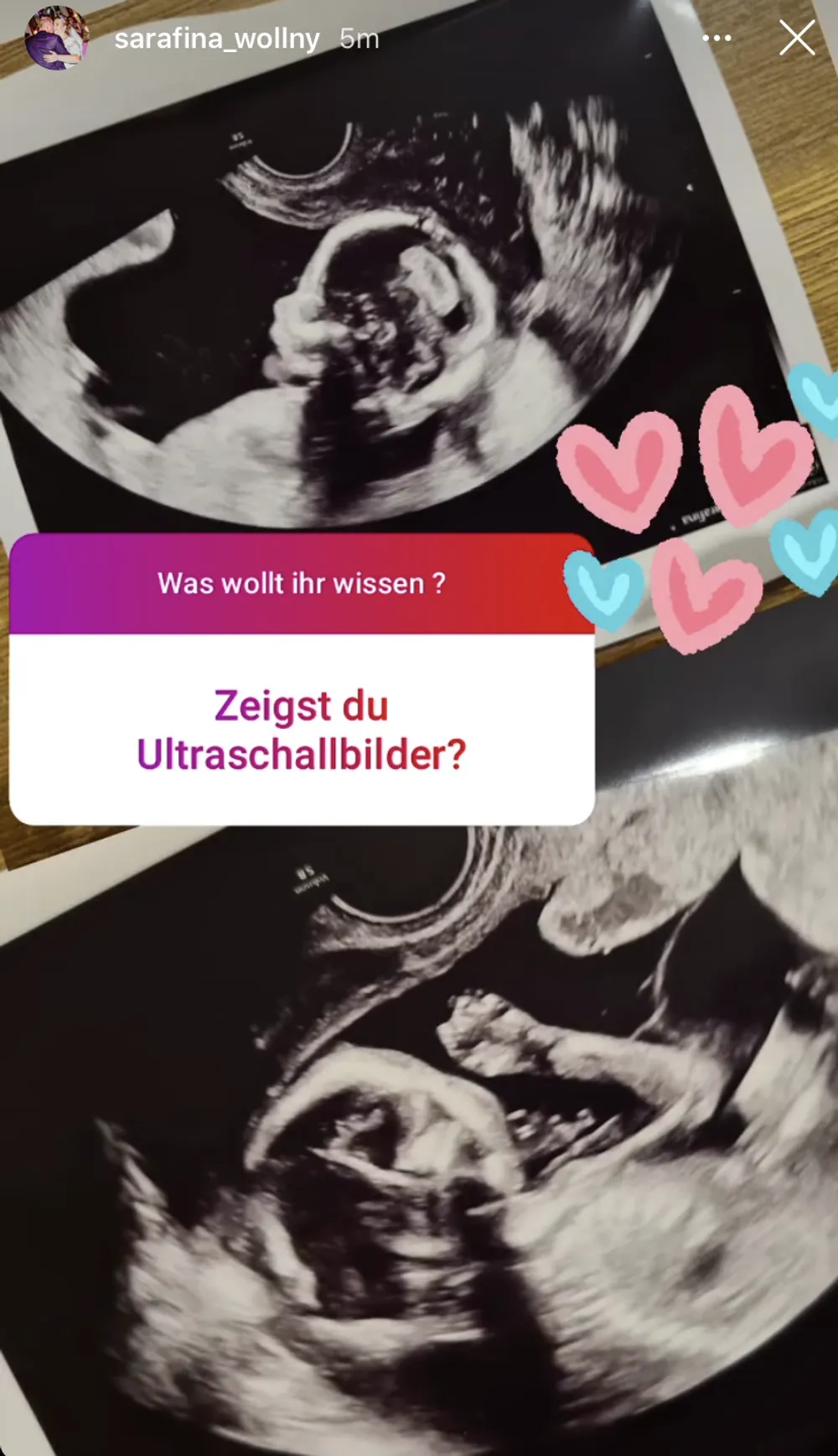 Sarafina Wollny Ultraschallbild Sarafina Wollny Ultraschallbild