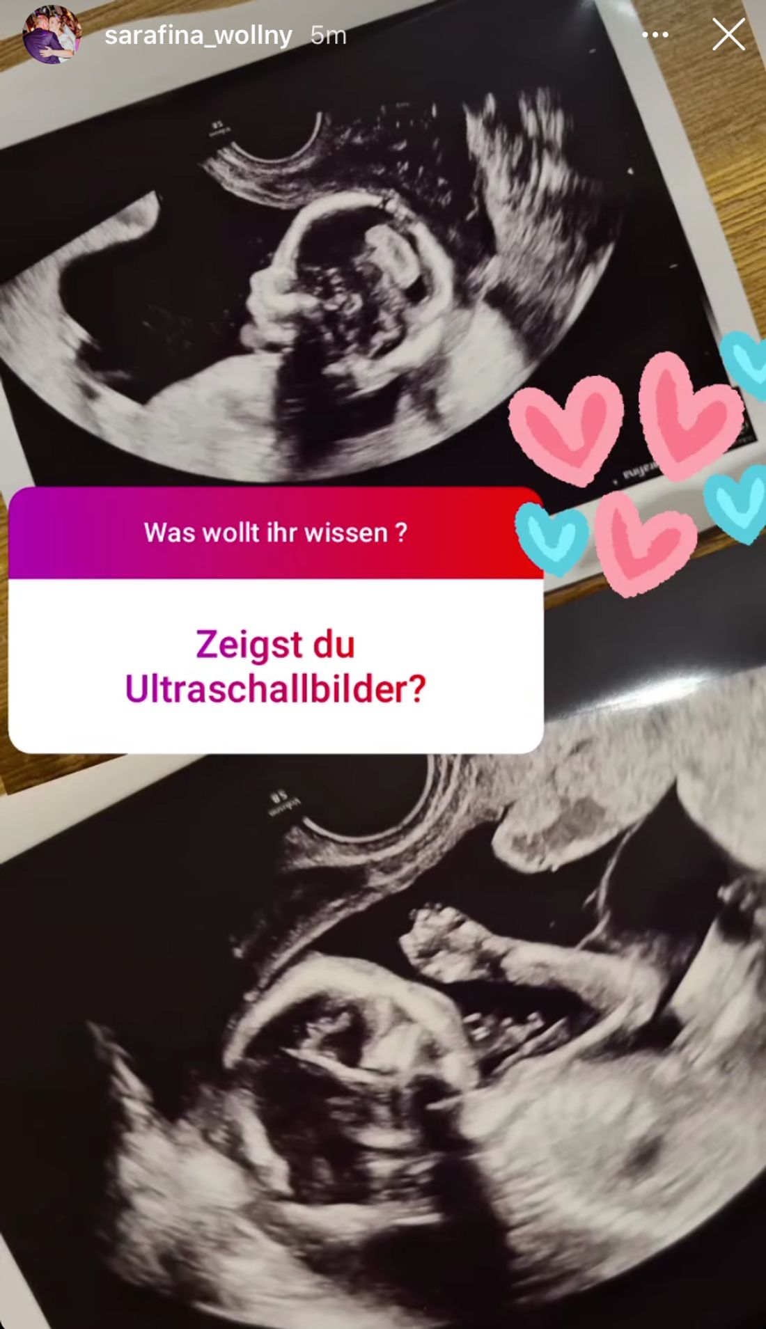 Sarafina Wollny Sie Zeigt Das Ultraschallbild Ihrer Babys Intouch