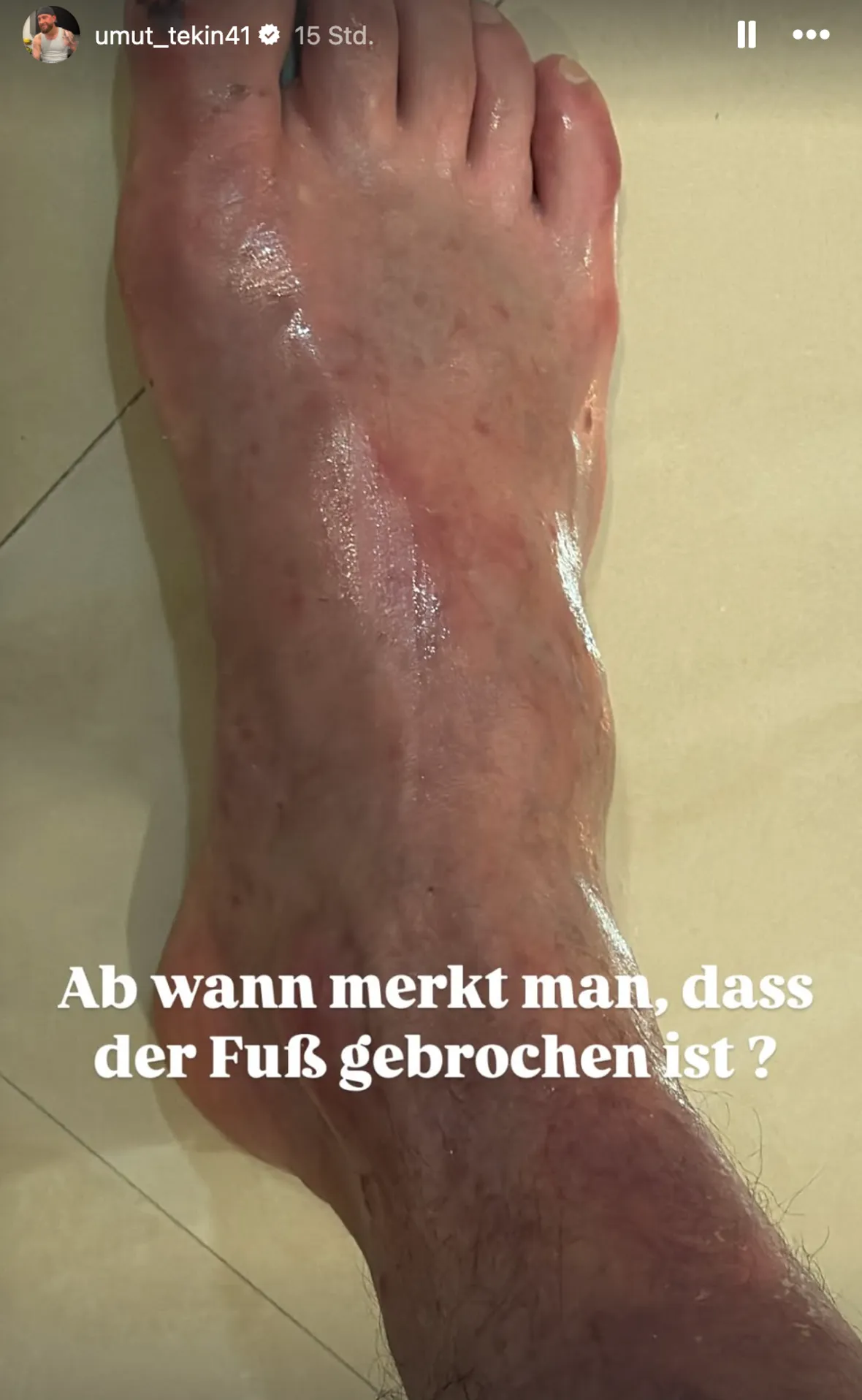Umut Tekin Fuß Umut Tekin Fuß