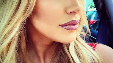 Lippen aufgespritzt: Vivien Konca war beim Beauty-Doc - Foto: Instagram / Vivien Konca